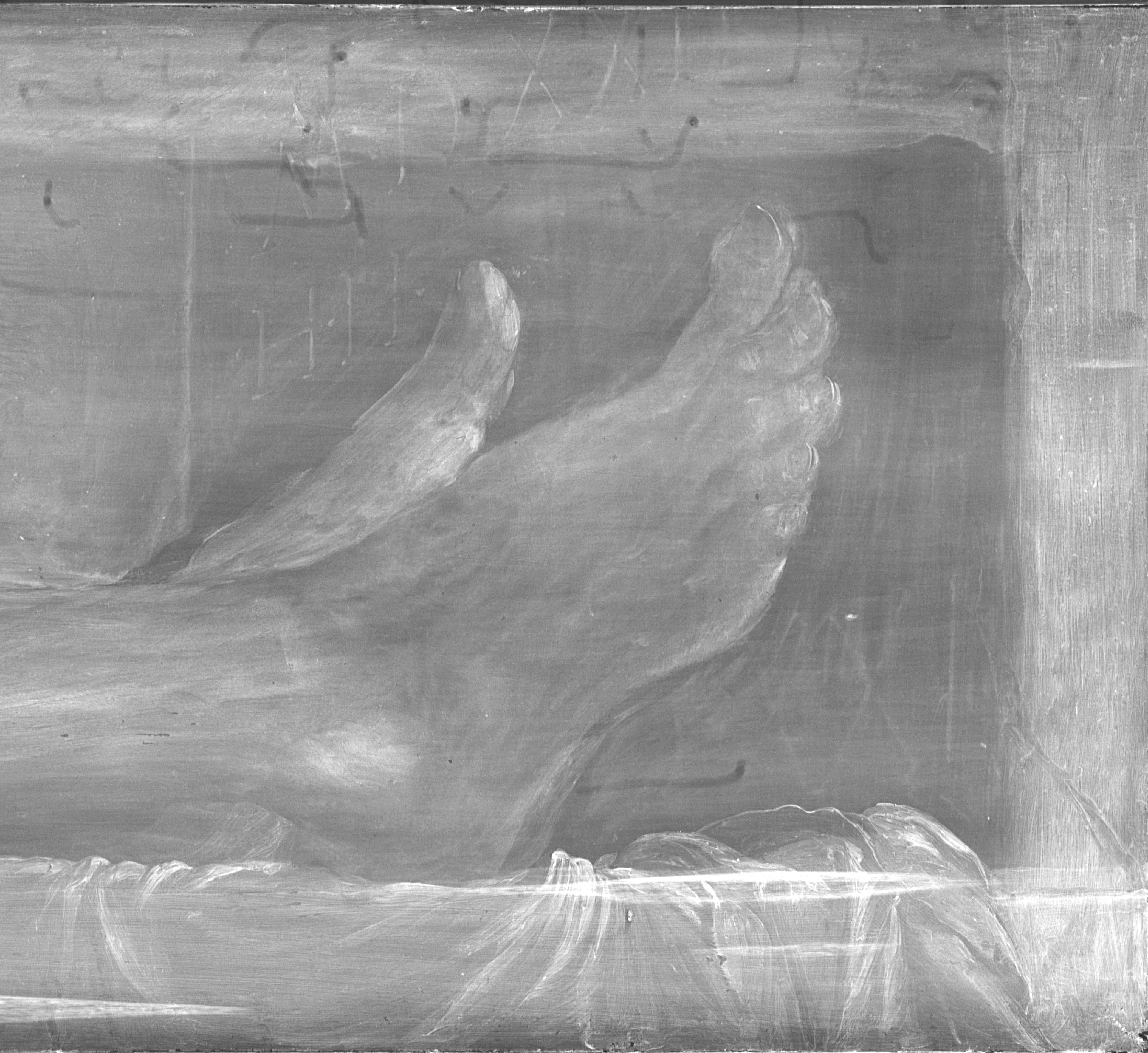 Radiography.